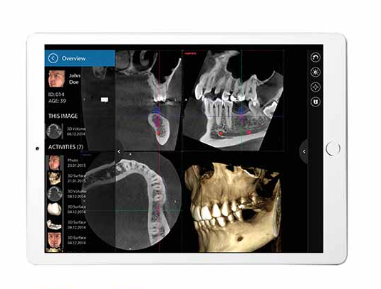 Revolutionäre KI-Lösungen in der Radiologie: Virtuelle Assistenten für exakte Bilddiagnostik